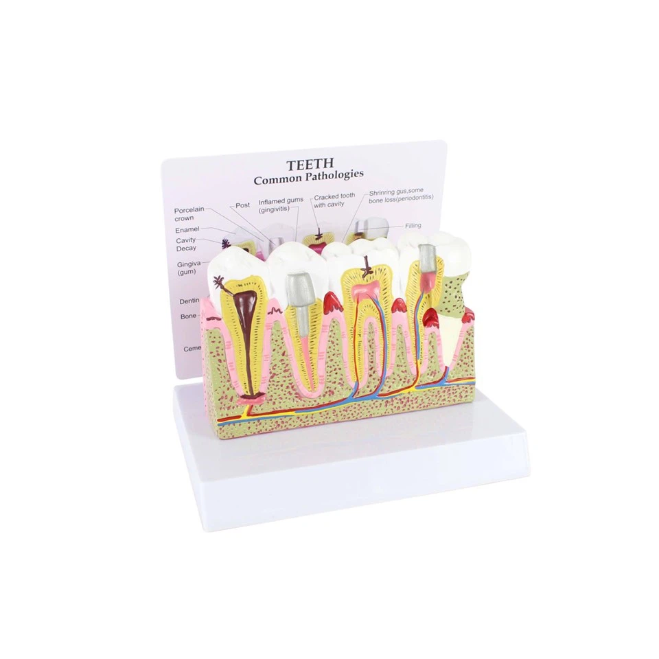 Dental Models And Teeth Pathology Models factory